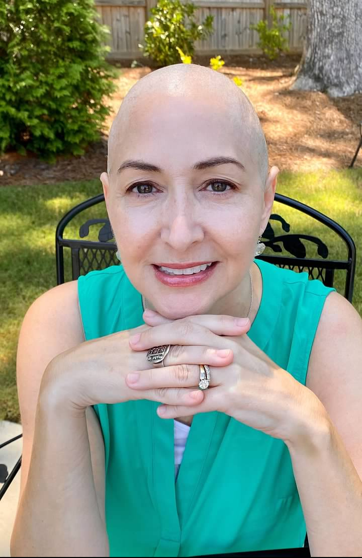 2nd Chemotherapy Treatment. Four more to go. Hair was coming out rapidly, so I shaved it all off.